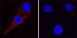 Kallikrein 3/PSA antibody in LNCaP and MCF-7 Human Cell Lines by Immunocytochemistry (ICC).