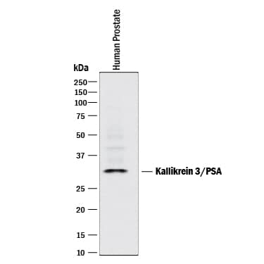 Detection of Human Kallikrein 3/PSA antibody by Western Blot.