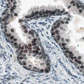 Kallikrein 4/Prostase/EMSP1 antibody in Human Prostate by Immunohistochemistry (IHC-P).