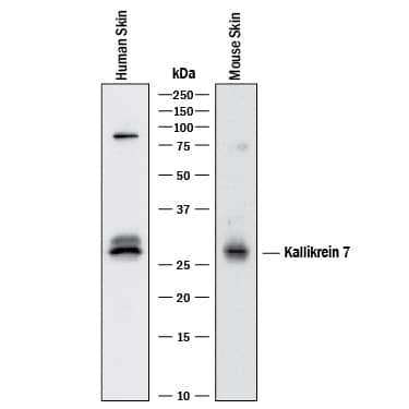 Detection of Human and Mouse Kallikrein 7 antibody by Western Blot.