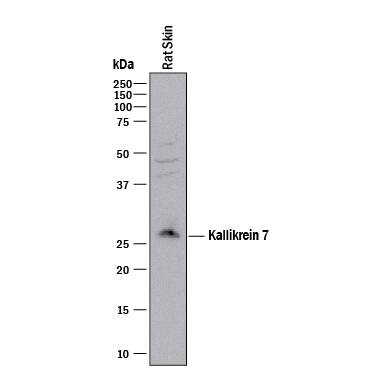 Detection of Rat Kallikrein 7 antibody by Western Blot.