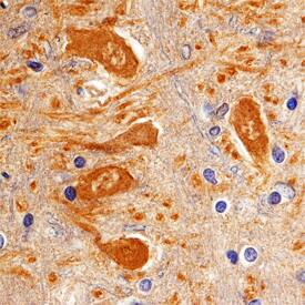 Katanin p60 antibody in Human Brain by Immunohistochemistry (IHC-P).