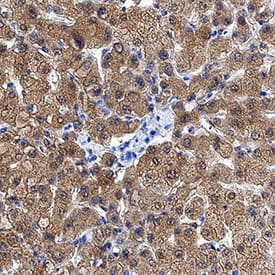 Ketohexokinase antibody in Human Liver by Immunohistochemistry (IHC-P).