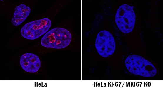 Ki67/MKI67 Antibody Specificity is Shown by Immunocytochemistry antibody in Knockout Cell Line.
