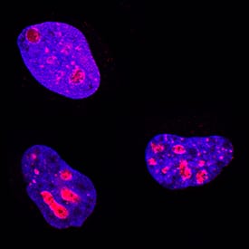 Ki67/MKI67 antibody in HeLa Human Cell Line by Immunocytochemistry (ICC).