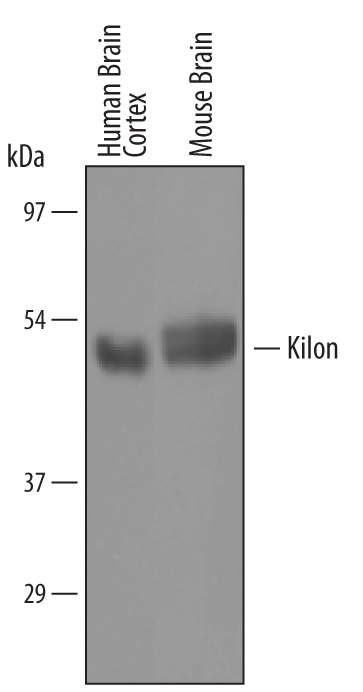 Detection of Human and Mouse Kilon/NEGR1 antibody by Western Blot.