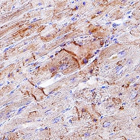 Kir2 by Immunohistochemistry (IHC-P).1 antibody in Human Heart by Immunohistochemistry (IHC-P).
