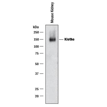 Detection of Mouse Klotho antibody by Western Blot.