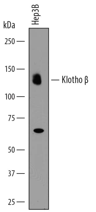 Detection of Human Klotho  beta antibody by Western Blot.