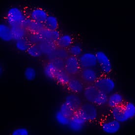 Klotho  beta antibody in HepG2 Human Cell Line by Immunocytochemistry (ICC).