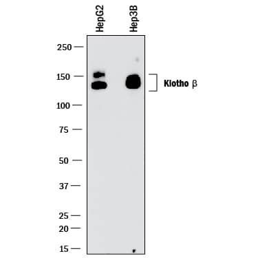 Detection of Human Klotho  beta antibody by Western Blot.