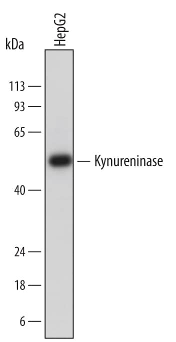 Detection of Human Kynureninase antibody by Western Blot.