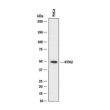 Detection of Human Kynureninase antibody by Western Blot.