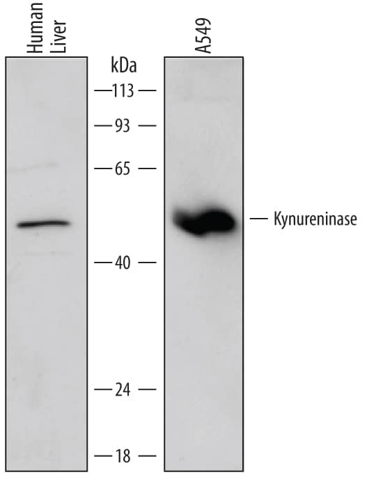 Detection of Human Kynureninase antibody by Western Blot.