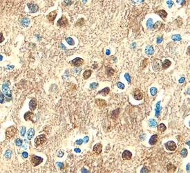 L1CAM antibody in Human Brain by Immunohistochemistry (IHC-P).