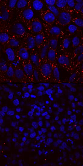 L1TD1 antibody in BG01V Human Embryonic Stem Cells by Immunocytochemistry (ICC).