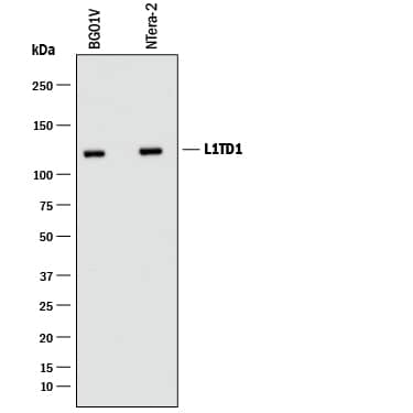 Detection of Human L1TD1 antibody by Western Blot.