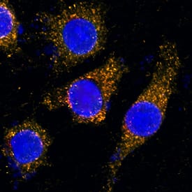 LAMP2/CD107b antibody in HeLa Human Cell Line by Immunocytochemistry (ICC).