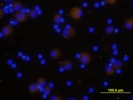 TGF-beta 1 antibody in Human PBMCs by Immunocytochemistry (ICC).