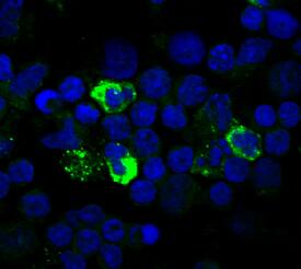 LAP (TGF-beta 1) antibody in Human PBMCs by Immunocytochemistry (ICC).