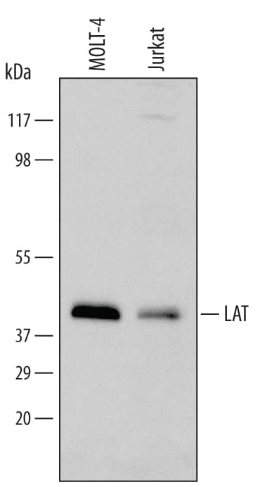 Detection of Human LAT antibody by Western Blot.