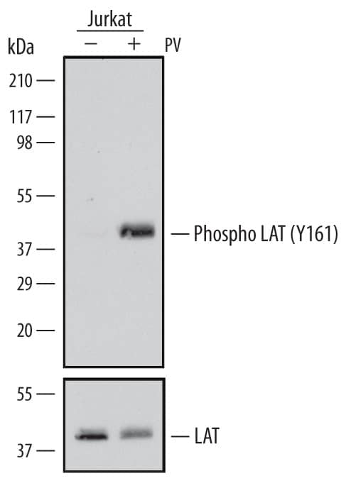 Detection of Human Phospho-LAT (Y161) antibody by Western Blot.