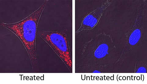 LC3B antibody in HeLa Human Cell Line by Immunocytochemistry (ICC).