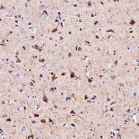 LC3A antibody in Human Brain by Immunohistochemistry (IHC-P).