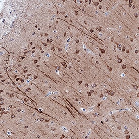 LC3A antibody in Human Brain by Immunohistochemistry (IHC-P).