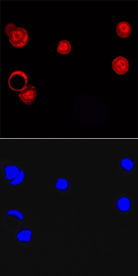 LCoR antibody in MCF-7 Human Cell Line by Immunocytochemistry (ICC).