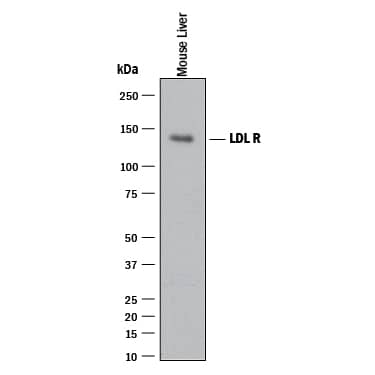 Detection of Mouse LDLR antibody by Western Blot.