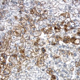 LDL R antibody in Human Liver by Immunohistochemistry (IHC-P).