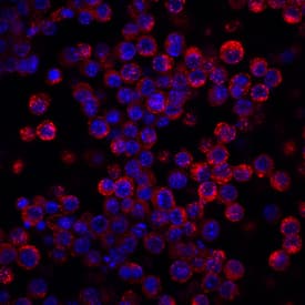 LDL R antibody in RAW 264 by Immunocytochemistry (ICC).7 Mouse Cell Line by Immunocytochemistry (ICC).