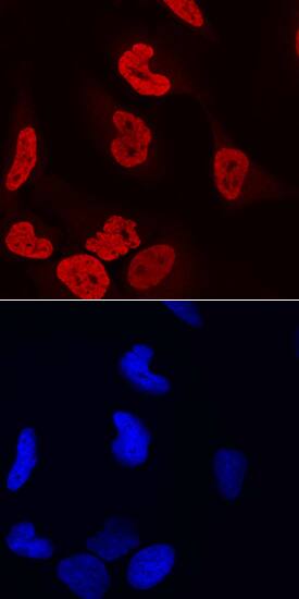 LEDGF antibody in HeLa Human Cell Line by Immunocytochemistry (ICC).