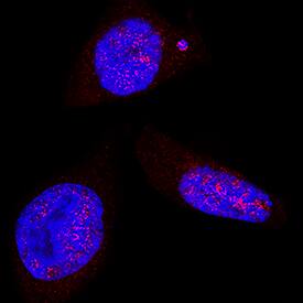 LEF1 antibody in Neuro-2A Mouse Cell Line by Immunocytochemistry (ICC).