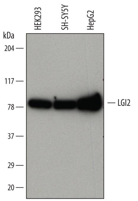 Detection of Human LGI2 antibody by Western Blot.