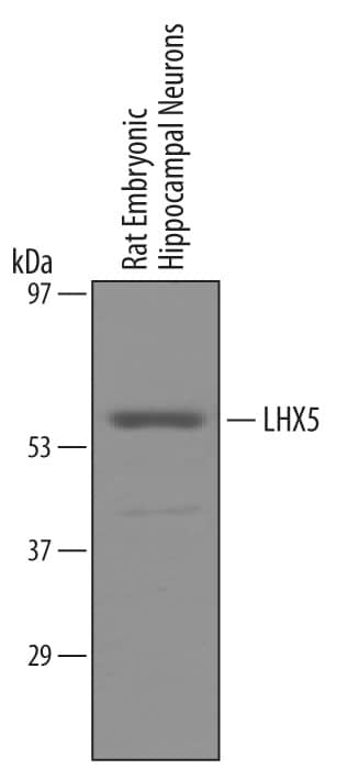 Detection of Rat LHX5 antibody by Western Blot.