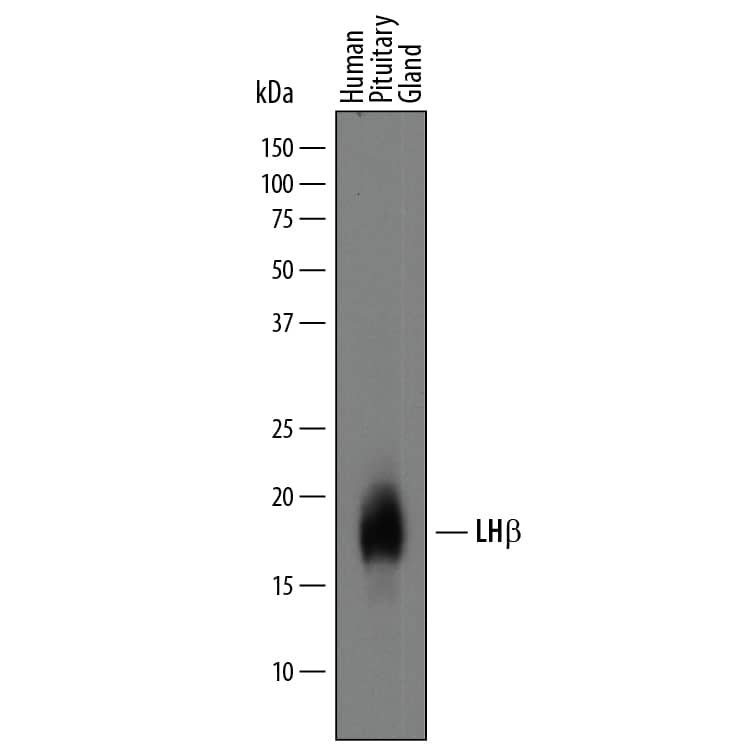 Detection of Human LH beta antibody by Western Blot.