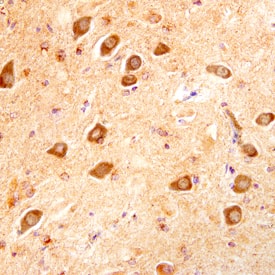 LIF antibody in Human Alzheimer's Brain by Immunohistochemistry (IHC-P).