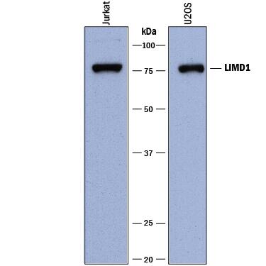 Detection of Human LIMD1 antibody by Western Blot.