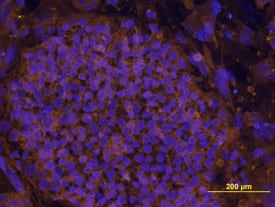 LIN-41 antibody in BG01V Human Stem Cells by Immunocytochemistry (ICC).