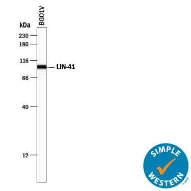 Detection of Human LIN-41 antibody by Simple WesternTM.