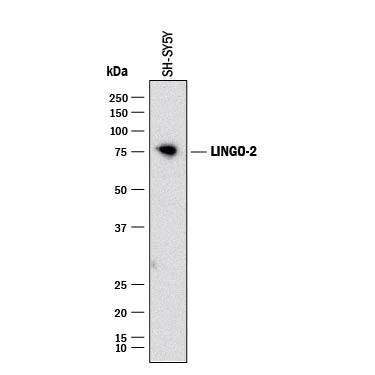 Detection of Human LINGO-2 antibody by Western Blot.