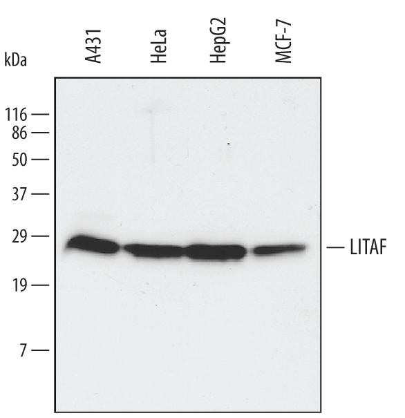 Detection of Human LITAF antibody by Western Blot.