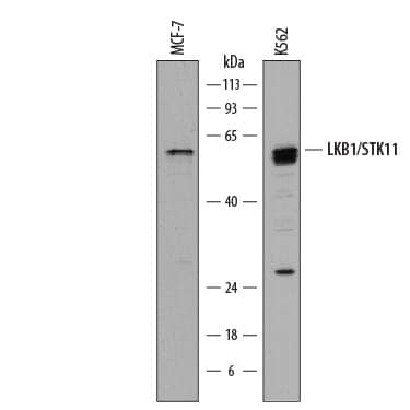 Detection of Human LKB1/STK11 antibody by Western Blot.