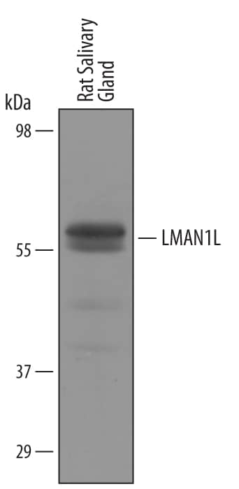 Detection of Rat LMAN1L/SLAMP antibody by Western Blot.