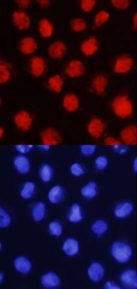 LMO2 antibody in K562 Human Cell Line by Immunocytochemistry (ICC).