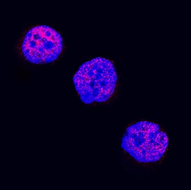 LMO2 antibody in K562 Human Cell Line by Immunocytochemistry (ICC).