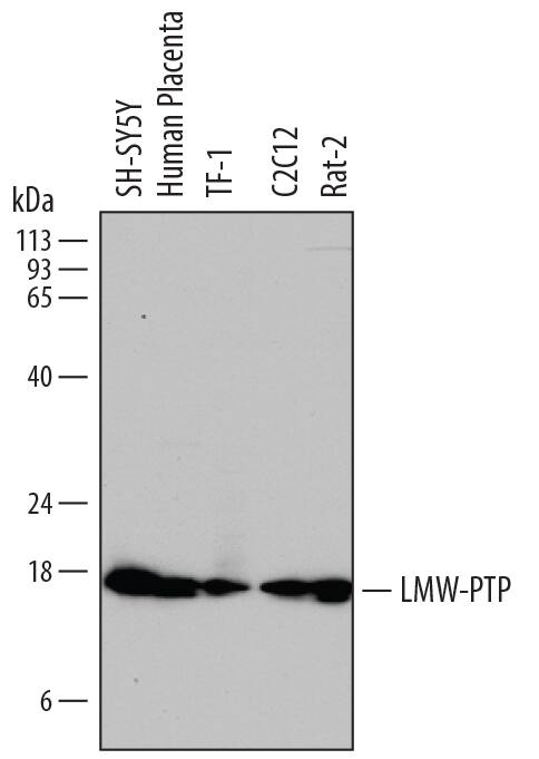 Detection of Human, Mouse, and Rat LMW-PTP/ACP1 antibody by Western Blot.