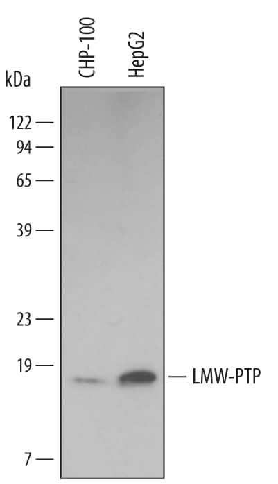 Detection of Human LMW-PTP/ACP1 antibody by Western Blot.